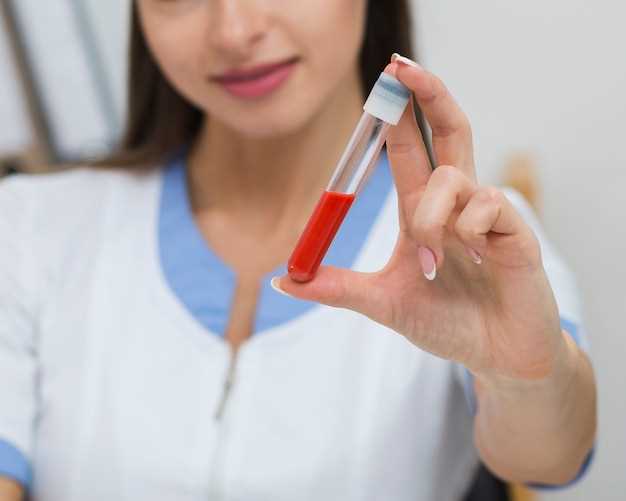 Почему важно соблюдать требования к сдаче общего анализа крови